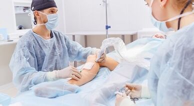 Chirurgie de varices